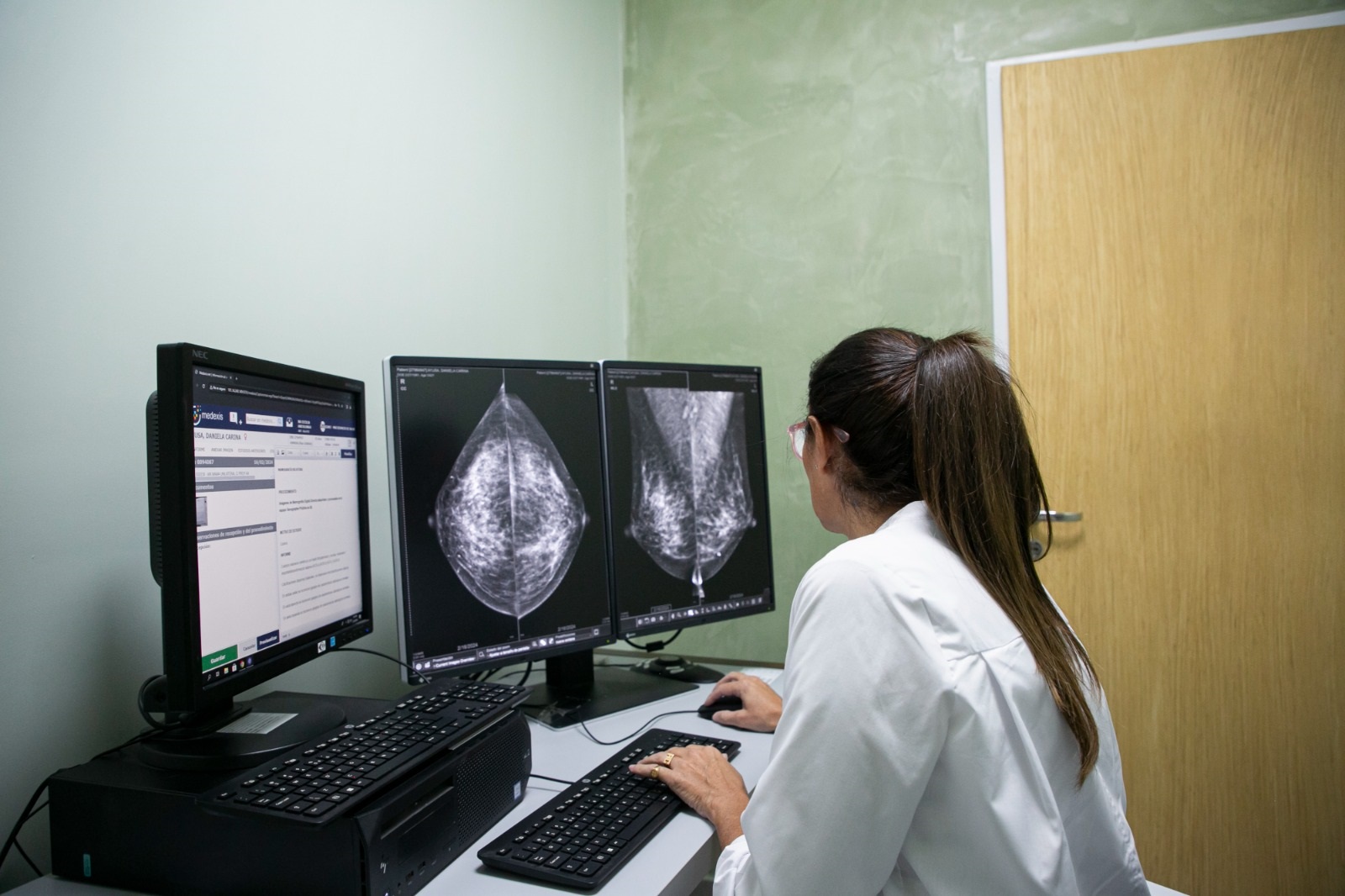 TOMOSÍNTESIS: EL REVOLUCIONARIO MÉTODO PARA LA DETECCIÓN PRECOZ DEL CÁNCER DE MAMA