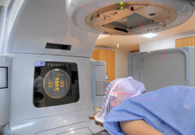 RADIOCIRUGÍA CEREBRAL ESTEREOTÁXICA: TENCONOLOGÍA DE VANGUARDIA AL SERVICIO DE LA SALUD EN TUCUMÁN.